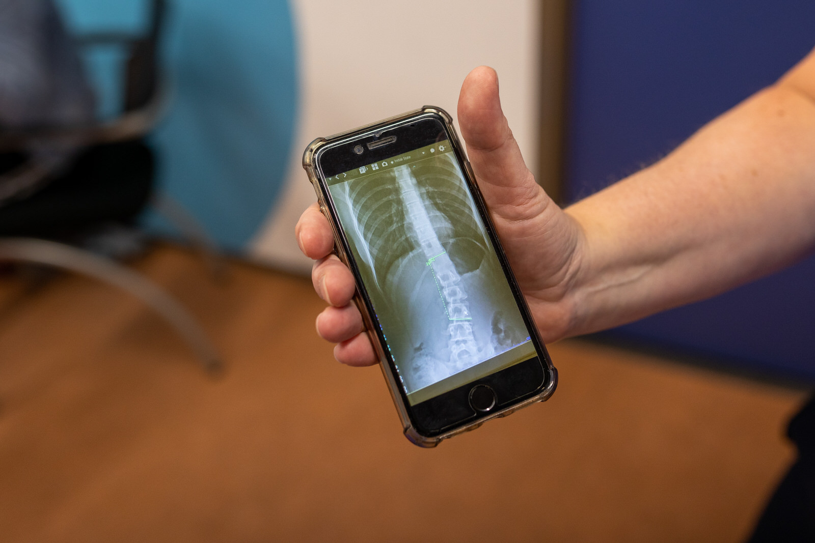 Wat doet Scolioteam?